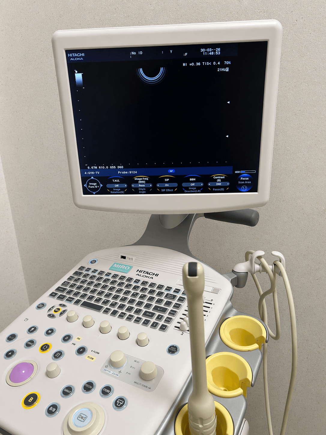 ALOKA UST 9124 Endocavity probe (1)